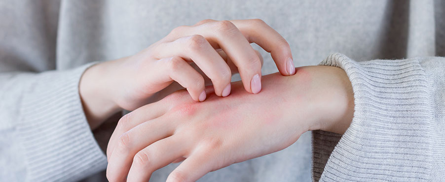 Charakterystyka skóry ze skłonnością do atopii