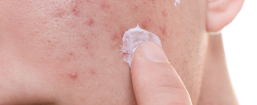 Nakładanie kosmetyku na cerę problematyczną